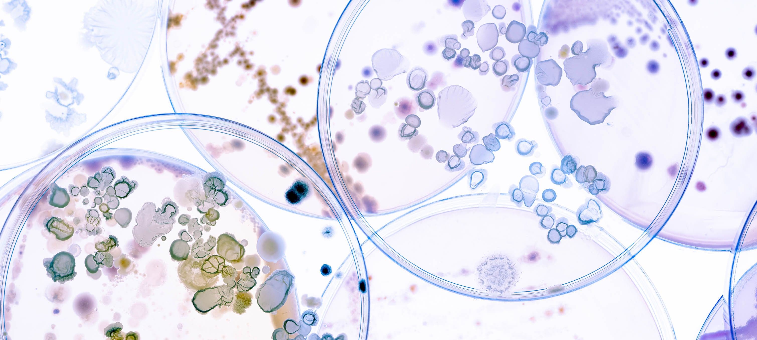 New technology to radically reduce the time taken to measure viable particle counts in air